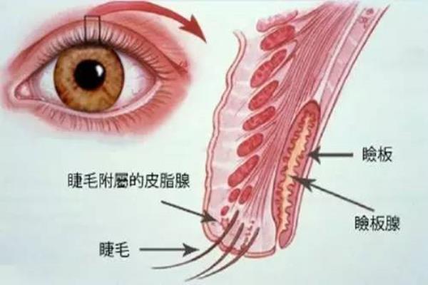 上眼皮突然鼓出来一个包（眼皮上长了个包）.