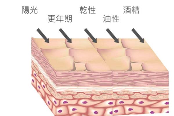 油性皮肤可以去角质层吗.