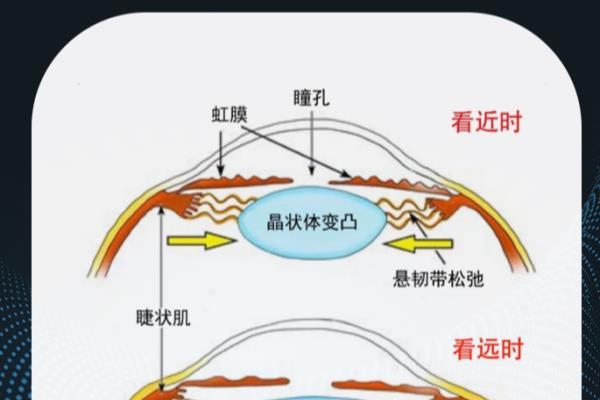 艾爵隐形眼镜怎么样.